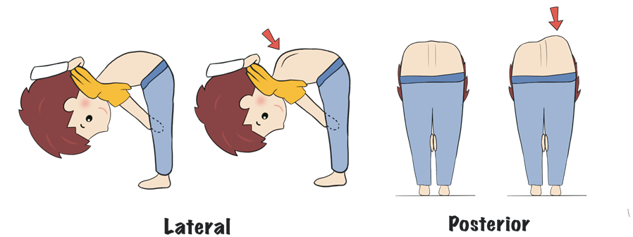 Bài kiểm tra Bend Forward Adams. Nguồn: Internet