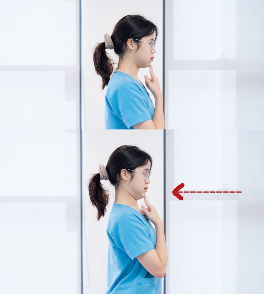 Bài tập thu cằm cải thiện đau cổ vai gáy