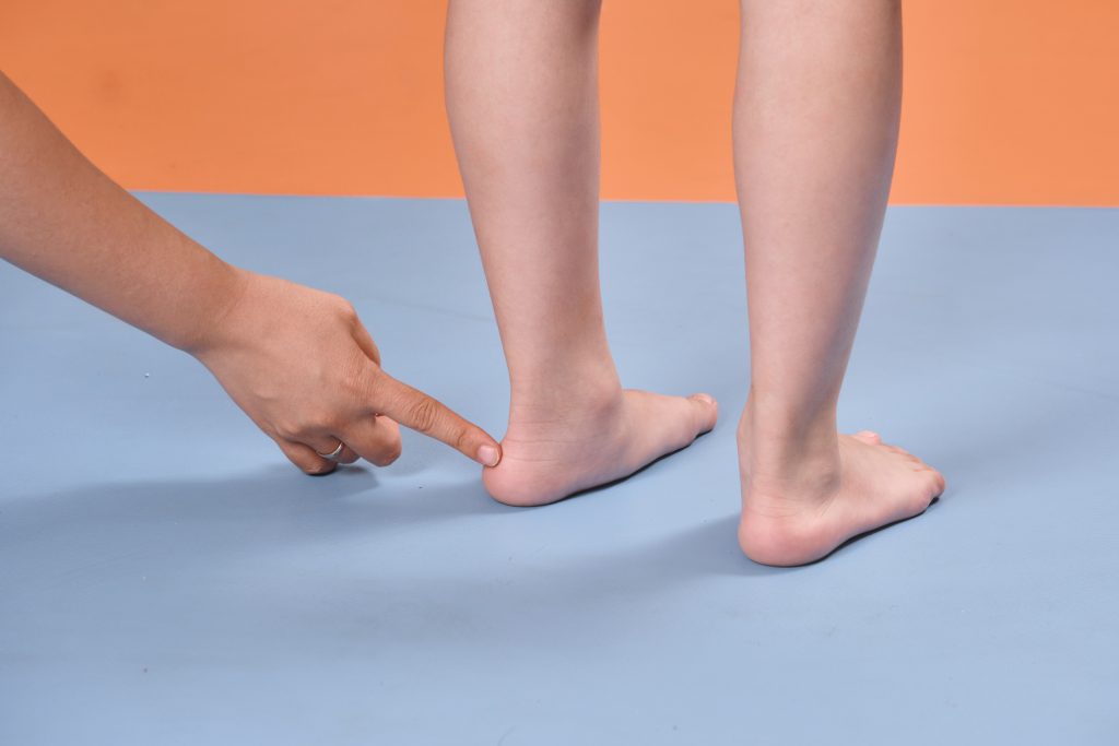 Cần thăm khám định kỳ khi sử dụng đế chỉnh hình
