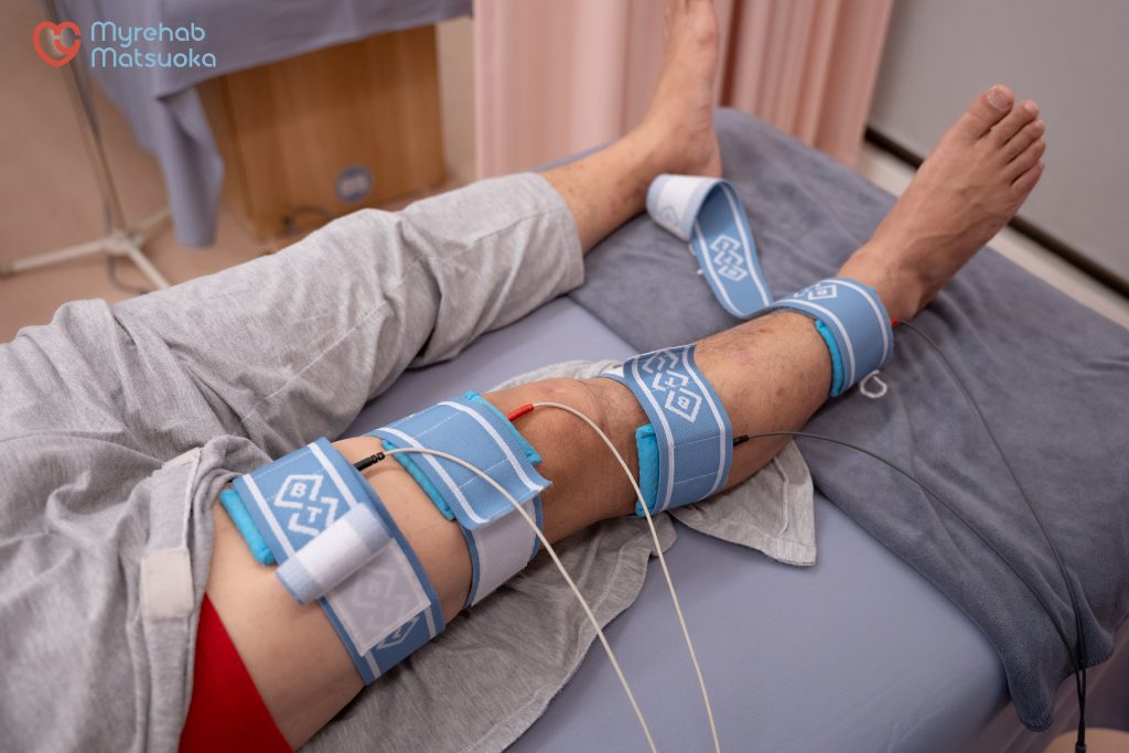 Điều trị tràn dịch khớp gối bằng điện xung trị liệu 