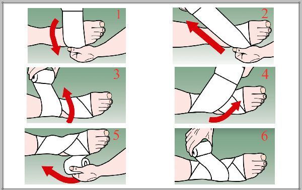 Hướng dẫn băng ép sau lật cổ chân