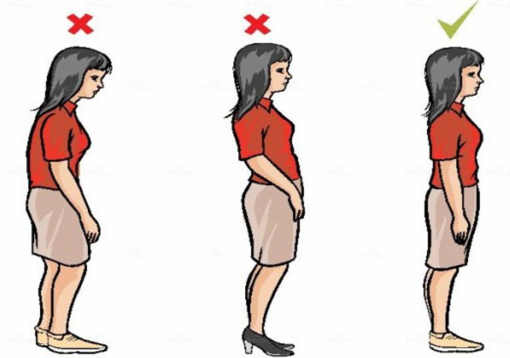 trẻ bị vẹo cột sống thường có dáng đi nghiêng vẹo