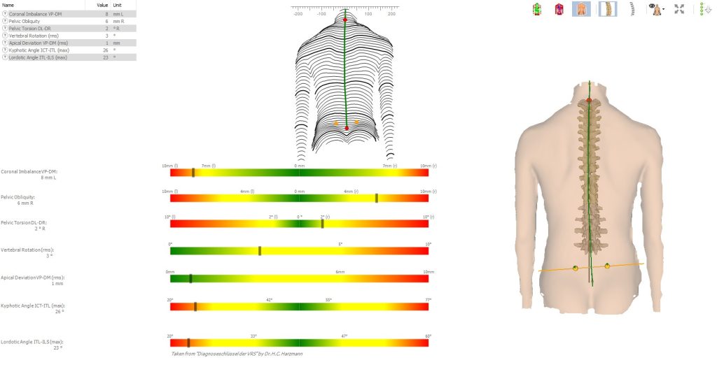 Hình ảnh hình thái cột sống chụp bằng máy DIERS tại myrehab matsuoka
