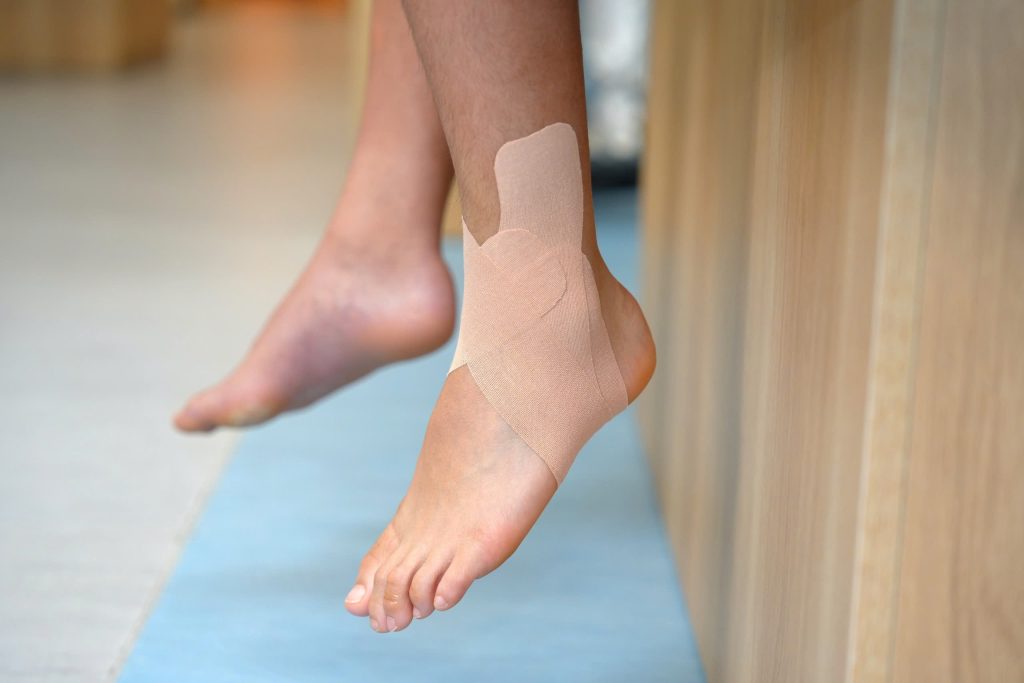 Theo dõi hậu phẫu cho bệnh nhân bàn chân bẹt