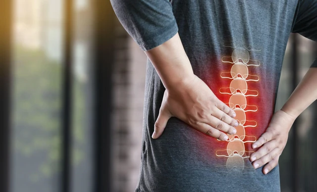 Cơn đau do thoát vị đĩa đệm gây tê liệt ở các vùng bị ảnh hưởng