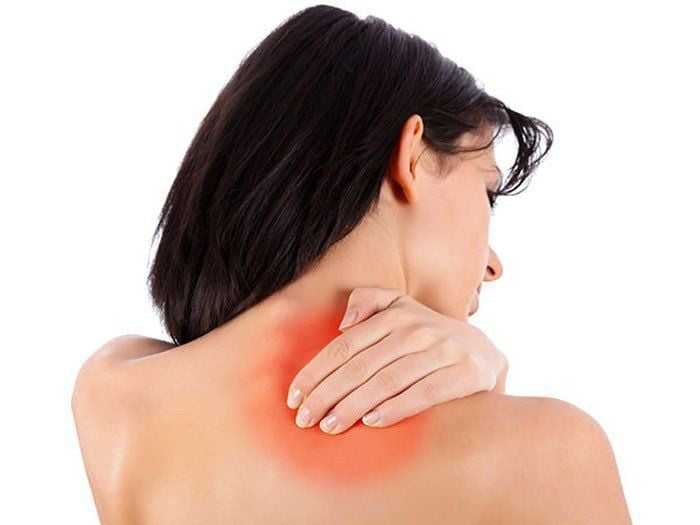 Trạng thái cứng cổ xuất hiện khi mô mềm gặp vấn đề