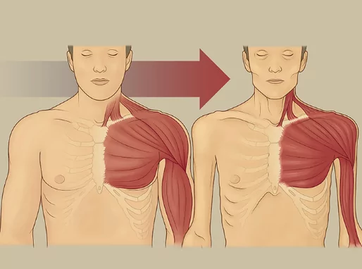 Thoái hoá khiến cơ bị teo và yếu đi theo thời gian