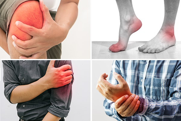 Thoái hóa khớp dẫn đến viêm khớp thứ phát