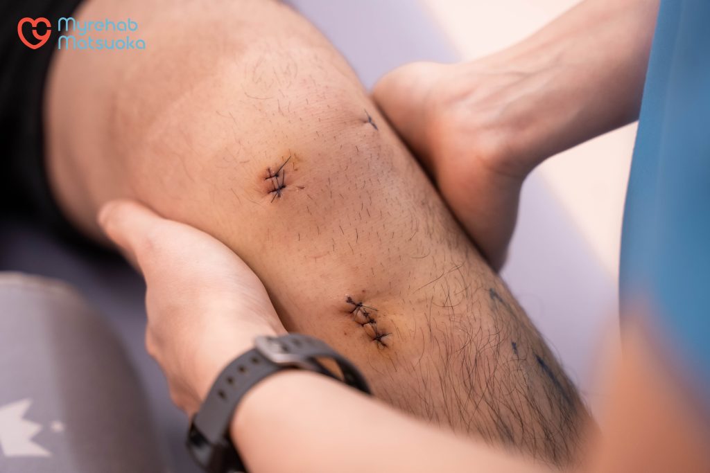 Người bệnh điều trị đúng tuyến BHYT sẽ giúp giảm chi phí phẫu thuật đứt dây chằng đầu gối