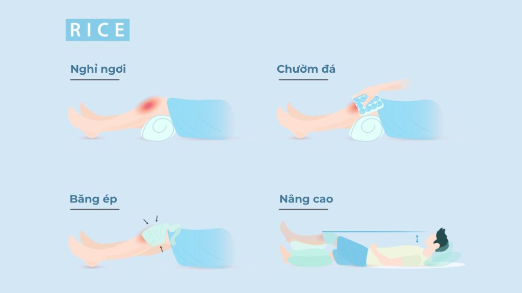 Sơ cứu chấn thương dây chằng bằng liệu pháp RICE