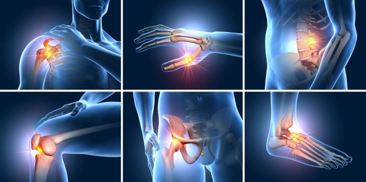 Đau khớp là biểu hiện sớm của các bệnh lý viêm khớp mạn tính