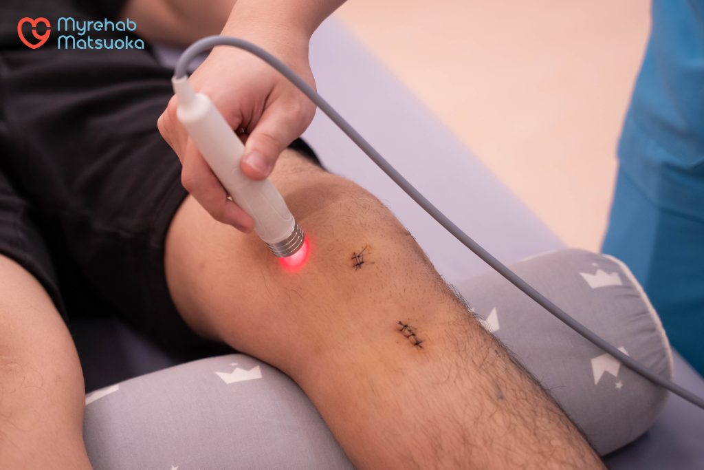 Phục hồi chức năng sau phẫu thuật dây chằng tại Myrehab Matsuoka