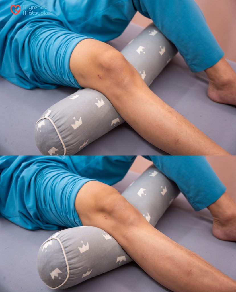 Bài tập co cơ tĩnh giúp kích hoạt sợi cơ sâu và duy trì lưu thông máu mà không gây áp lực lên ổ gãy chưa liền vững