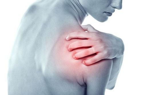 Vận động mạnh hoặc sai tư thế gây tái phát cơn đau vai
