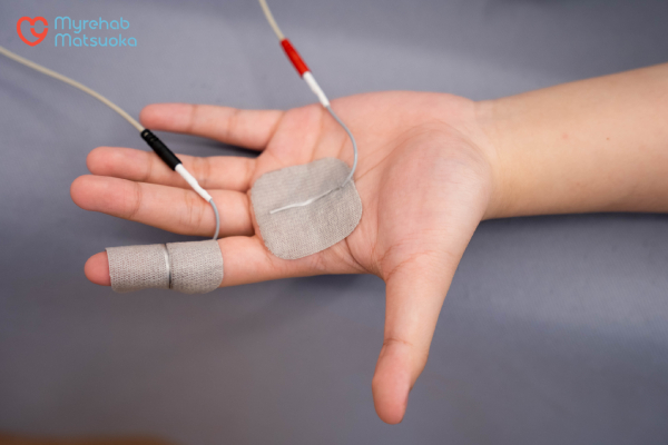 Phương pháp điện xung trị liệu trị liệu ngón tay lò xo tại Myrehab Matsuoka