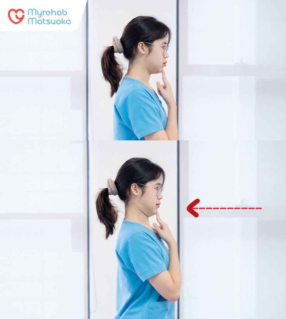 Bài tập thu cằm giúp điều chỉnh trục cột sống cổ, giảm áp lực lên vùng cổ vai gáy do tư thế cúi đầu