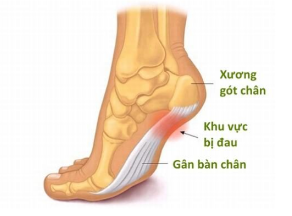 Vị trí của gân bàn chân
