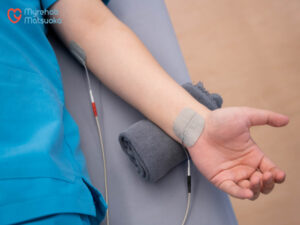 Vật lý trị liệu hội chứng ống cổ tay