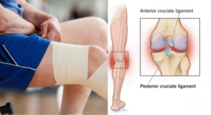 Thời gian hồi phục chấn thương sẽ phù thuộc vào mức độ chấn thương.