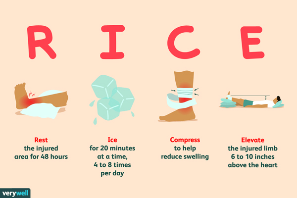 Nghỉ ngơi (rest), chườm đá (ice), băng ép (compress), kê cao vị trí chấn thương (elevate) là các bước sơ cứu cần thiết.