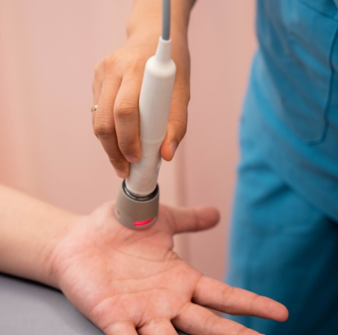 Vật lý trị liệu hội chứng ngón tay lò xo