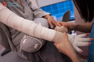 Bằng ép là một trong các bước điều trị phù bạch huyết