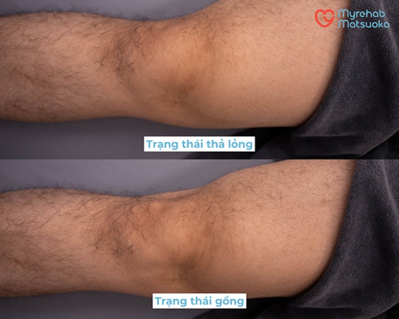 Bài tập gồng cơ tứ đầu đùi.