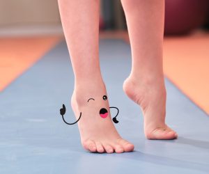 dáng đi được cải thiện khi dùng đế chỉnh hình bàn chân bẹt