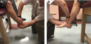 Anterior drawer test ankle