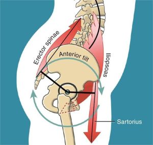 Mối liên hệ giữa khung chậu nghiêng và tăng ưỡn cột sống