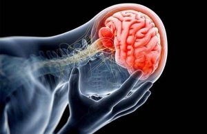 Rối loạn tiền đình là gì?