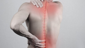 Số lượng bệnh nhân mắc cong vẹo cột sống ngày càng gia tăng