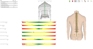 Hệ thống DIERS formetric 4D tại Myrehab Matsuoka