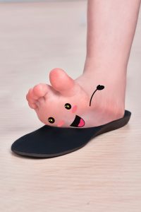 giày chỉnh hình bàn chân bẹt tại myrehab matsuoka