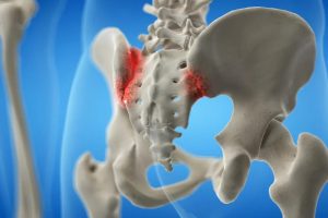 Bệnh lý: Viêm khớp cùng chậu