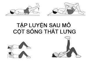Tập luyện phục hồi cột sống tại nhà