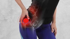 Tình trạng đau mỏi khớp háng ở người chơi thể thao
