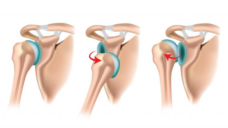 Trật khớp vai ra trước và về sau