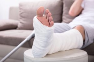 Bó bột cẳng chân ảnh hưởng đến việc chịu lực, khớp gối và cơ chân
