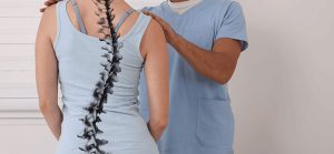 Có rất nhiều nguyên nhân dẫn đến vẹo cột sống vô căn ở thanh thiếu niên