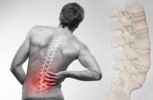 Đau lưng kéo dài ảnh hưởng đáng kể đến sinh hoạt hằng ngày