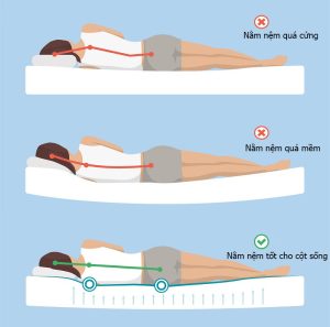 Sử dụng đệm quá mềm hoặc quá cứng cũng là một trong những nguyên nhân phổ biến gây đau lưng